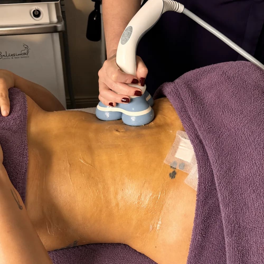 A Belíssima specialist applying an aesthetic technology device to a client's abdomen during a fibrosis prevention session