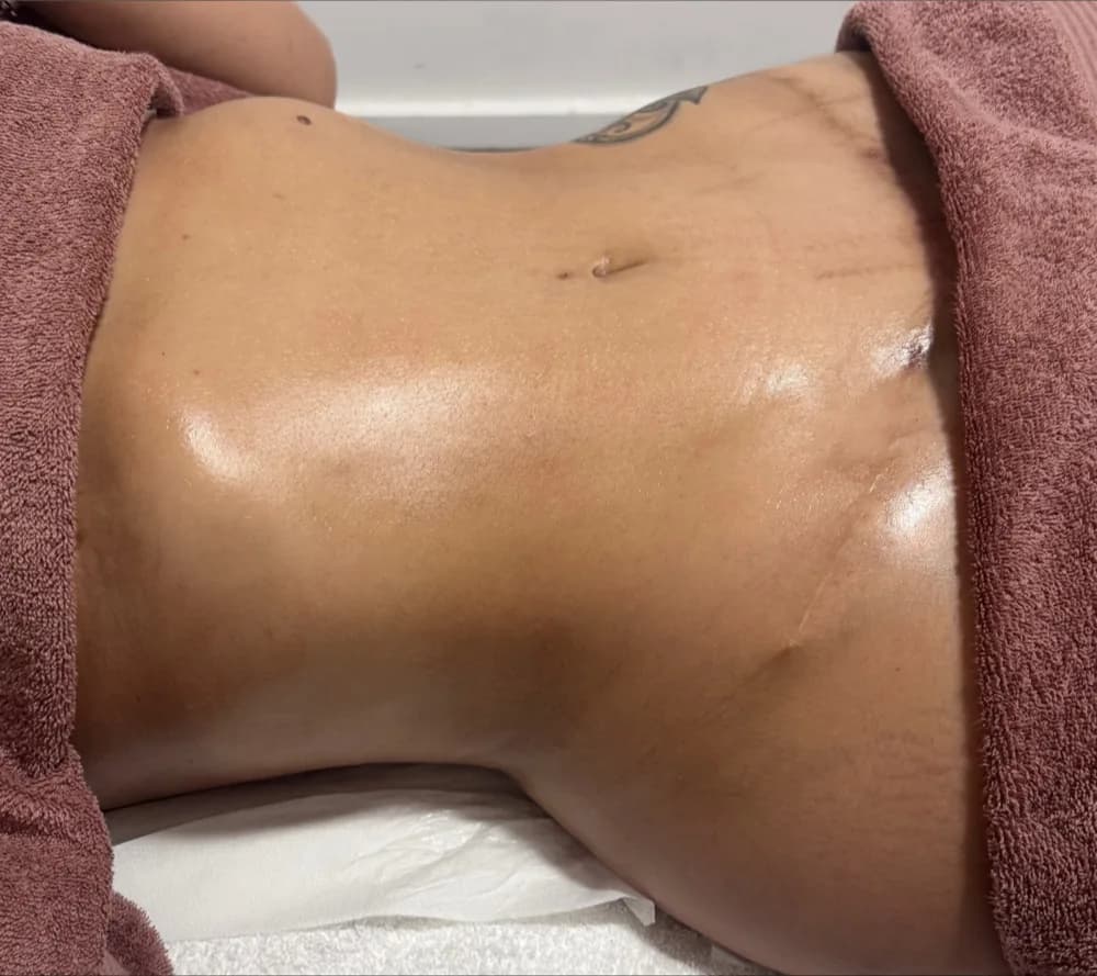 After the recovery programme, abdomen