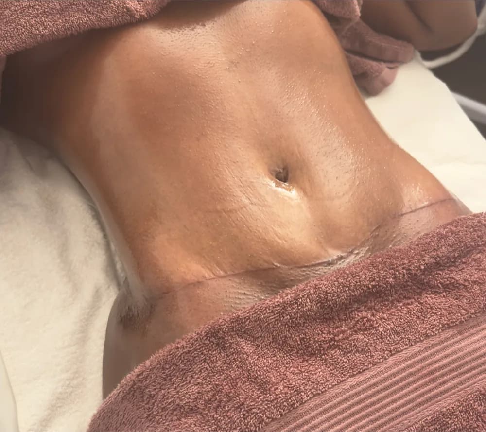 After the recovery programme, abdomen