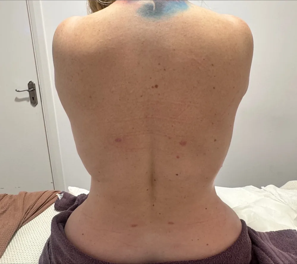 After the recovery programme, back