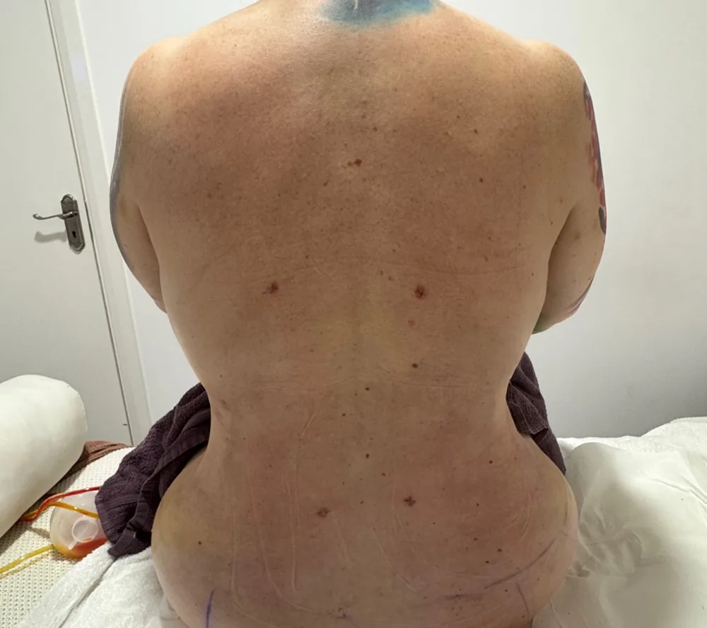 Before the recovery programme, back