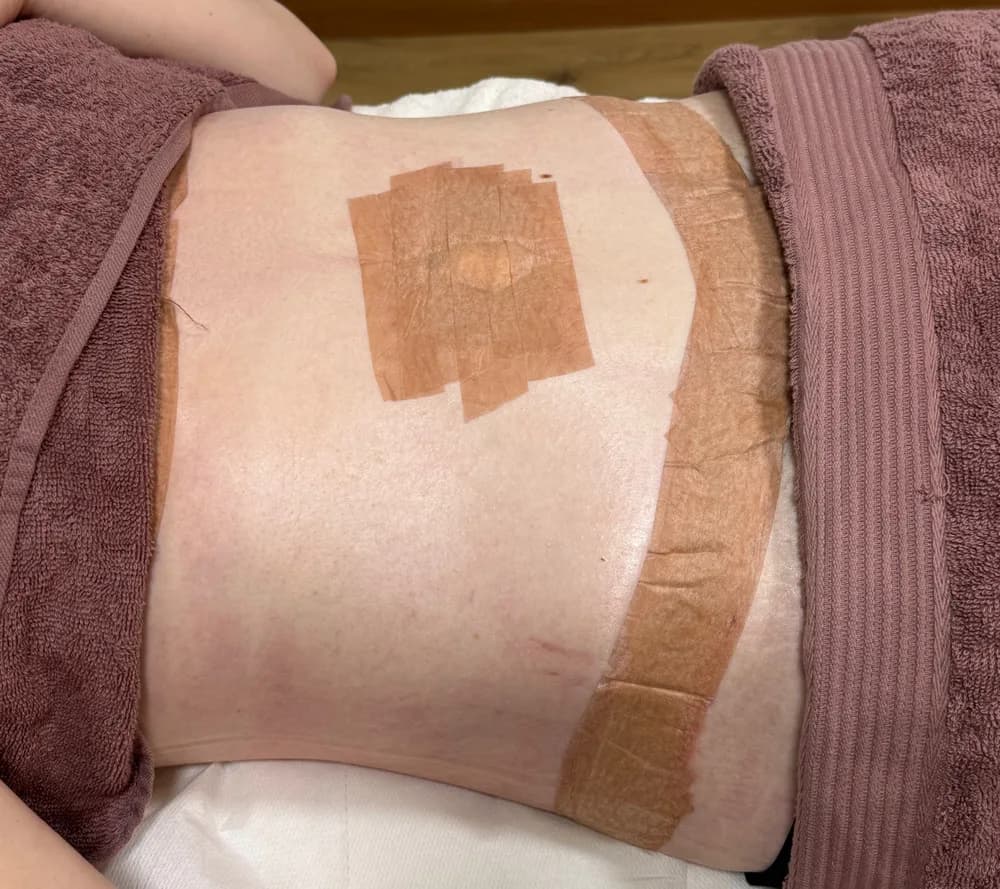 Before the recovery programme, abdomen